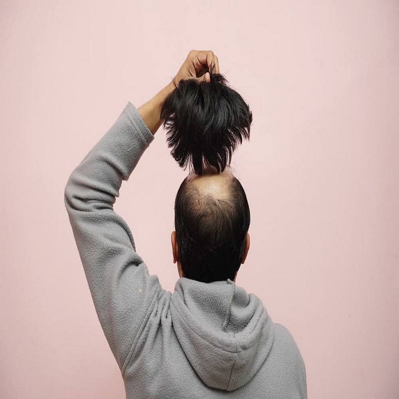 hair fixing service in kolkata