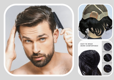 hair patch service in howrah
