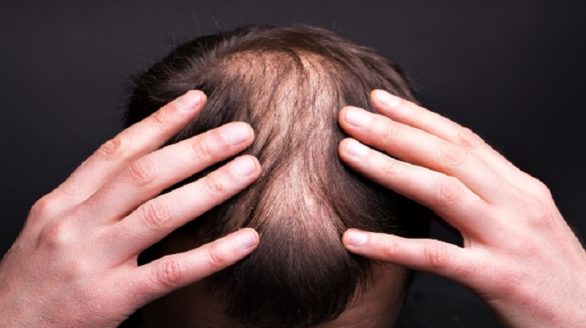 hair bonding service in howrah